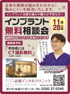 インプラント無料相談会